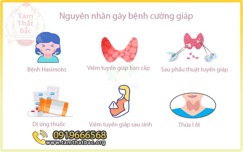 4. Phương pháp chẩn đoán cường giáp