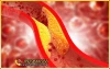 Cholesterol là gì ? Mức tiêu chuẩn Cholesterol trong máu